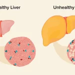 Discovering the Key Indicators of Liver Disease through Ultrasound