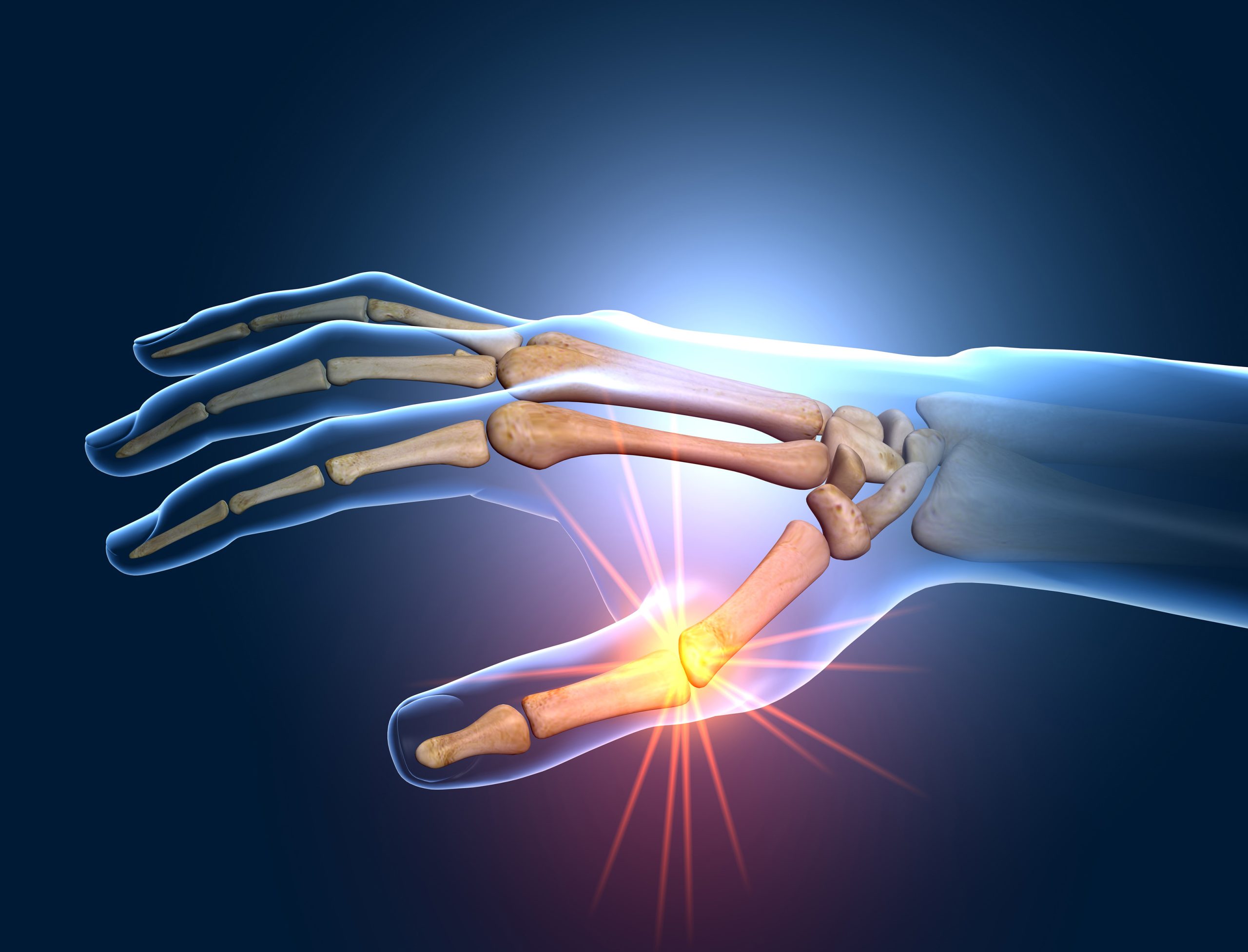 illustration showing the thumb joint, fingers and bone structure of the hand