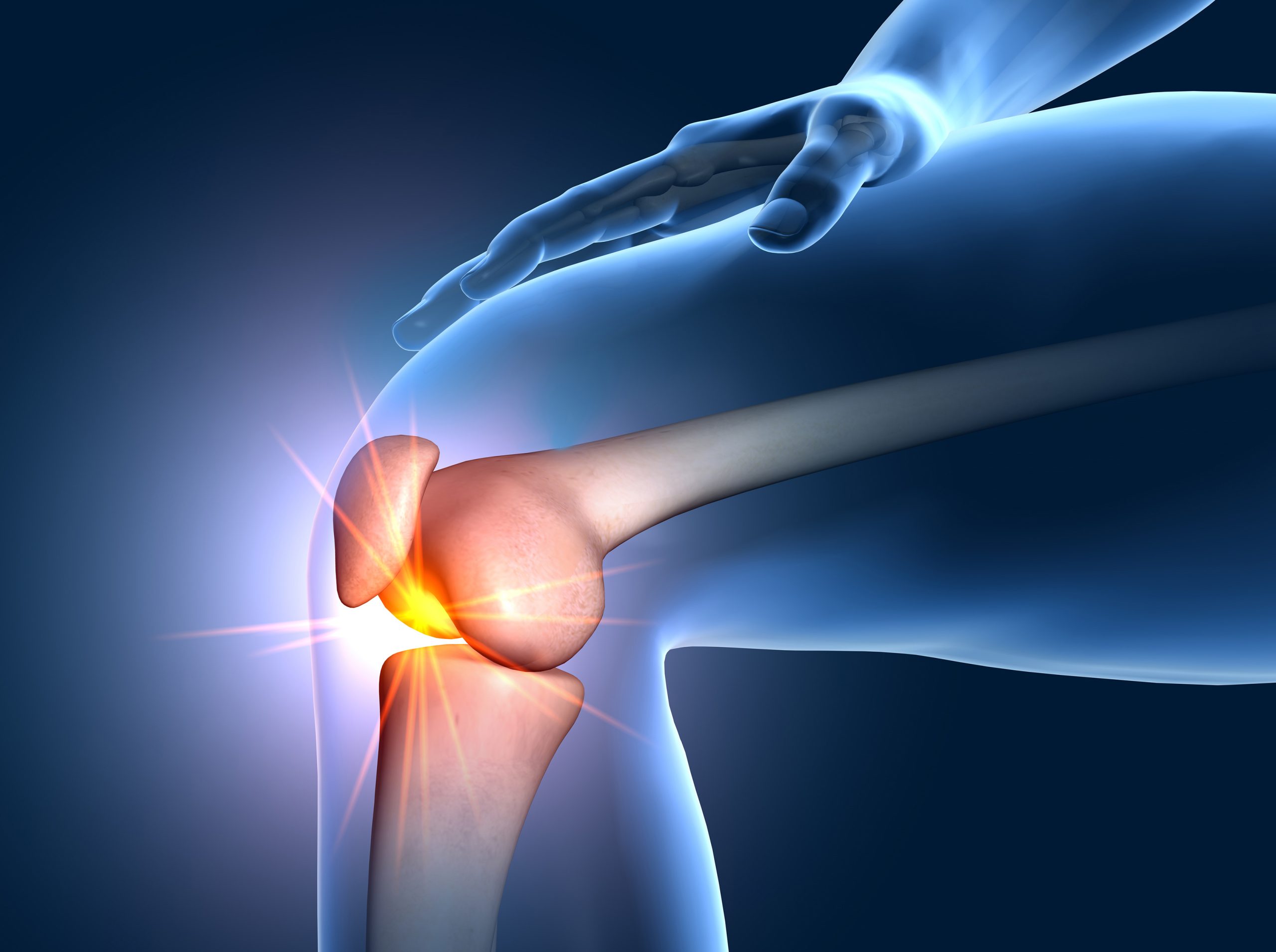 arthritis is often found at the knee joint as illustrated