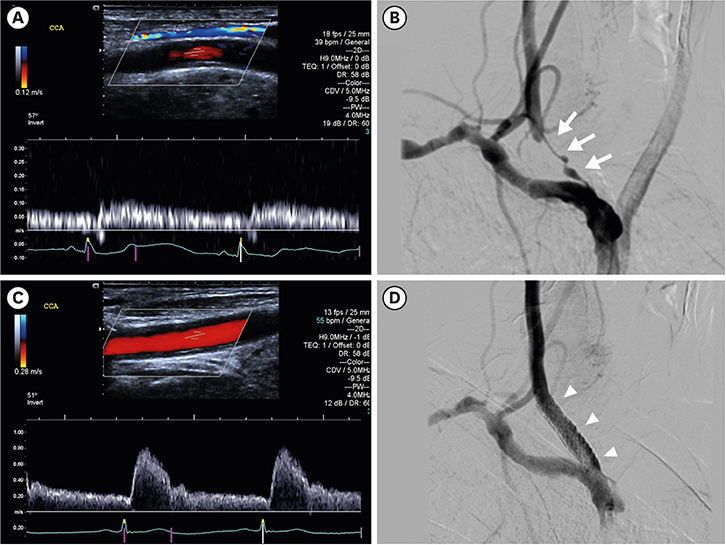 ultrasound image - showing the detail of the scans